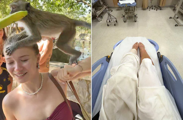 태국 관광지서 원숭이 떼 몰려들더니 다리 '꽉'..."야생동물, 예측 불가... - 뉴스 썸네일 이미지